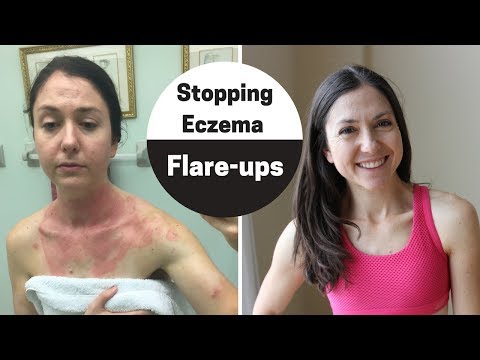 Video: Cara Menghindari Flare-Up Dermatitis Atopik