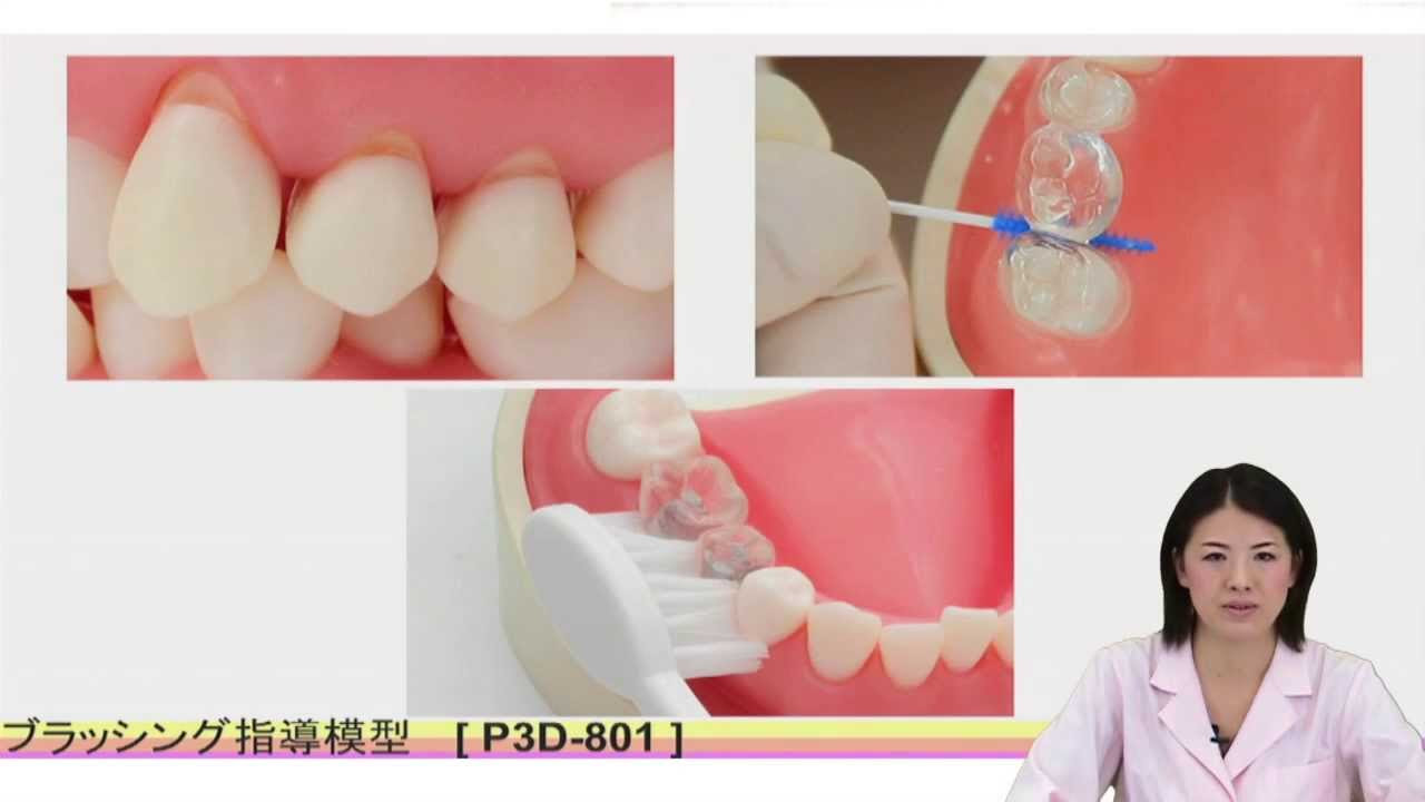 歯磨き指導用顎模型 [PE-STP001]（旧型番：P3D-801） - YouTube