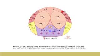 Core Videos (2020): Transperineal Prostate Biopsy Demonstration