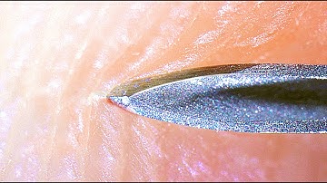NEEDLE IN TO HUMAN SKIN - [under microscope]