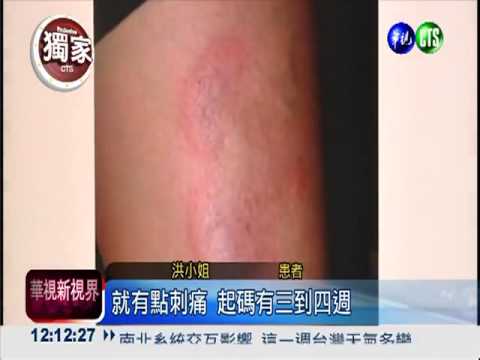 莱姆病的用药细节 Lyme Disease prophylaxis and treatment