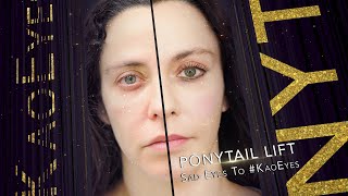 NOT A Facelift! Ponytail Lift™ - KaoEyes - Fox Eyes - KAO Plastic Surgery - There Is No Substitute