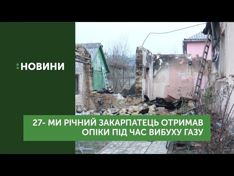 27-річний закарпатець отримав опіки під час вибуху газу