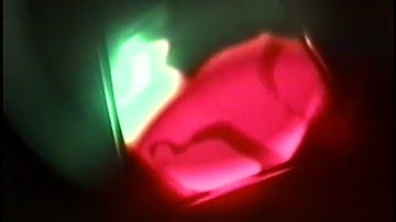 Lightning Bug - Song of the Bell (Official Lyric Video)