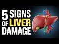 علائم آسیب کبدی که نباید نادیده بگیرید 5 هشدار اولیه که می تواند زندگی شما را نجات دهد نکات بهداشتی ویروسی 