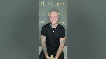 Scalp Micropigmentation (SMP) Client Testimonial