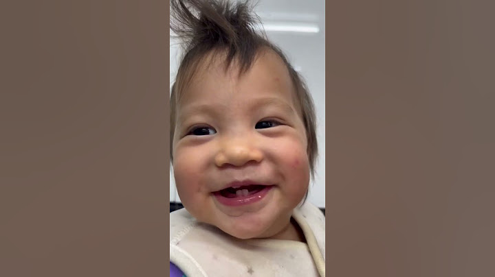 The difference between tie or not tie up baby’s hair 寶寶綁髮與不綁髮的差別 #cutebaby
