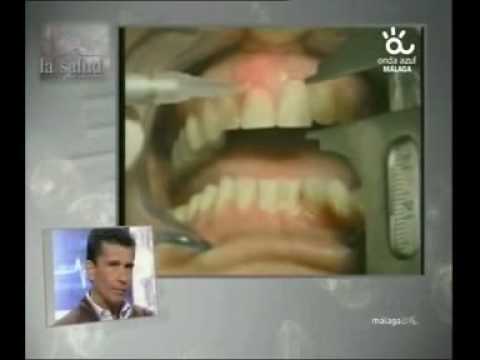 Clinica Dental Cuevas Periodoncia 1