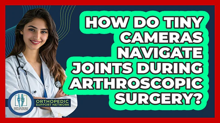 How Do Tiny Cameras Navigate Joints During Arthroscopic Surgery? - Orthopedic Support Network