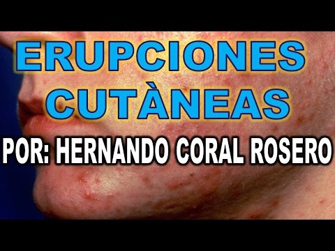 Vídeo: Sarpullido: 22 Erupciones Cutáneas Comunes, Imágenes, Causas Y Tratamiento