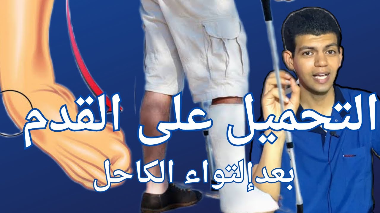 التواء القدم /التحميل المباشر بعد الجبس