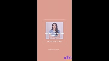 Iris Transillumination Defects: Dr. Elise Kramer
