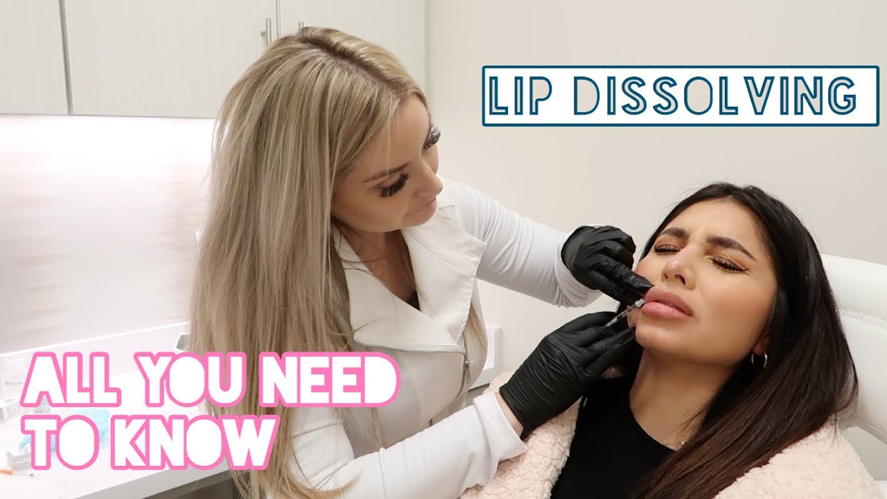 MOST Painful Thing Ever!!! 😭 Got My Lips Dissolved! Jaw Filler Update