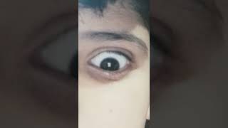 I try trending eyes reflux#funny #comedy #minivlog #vlog #viralyoutubeshorts