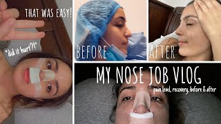 Rhinoplasty Vlog | My Nose Job Experience *EASY!* Rhinoplasty Vlog | My Nose Job Experience *EASY!*