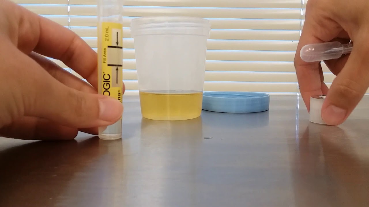 Transferring a urine sample
