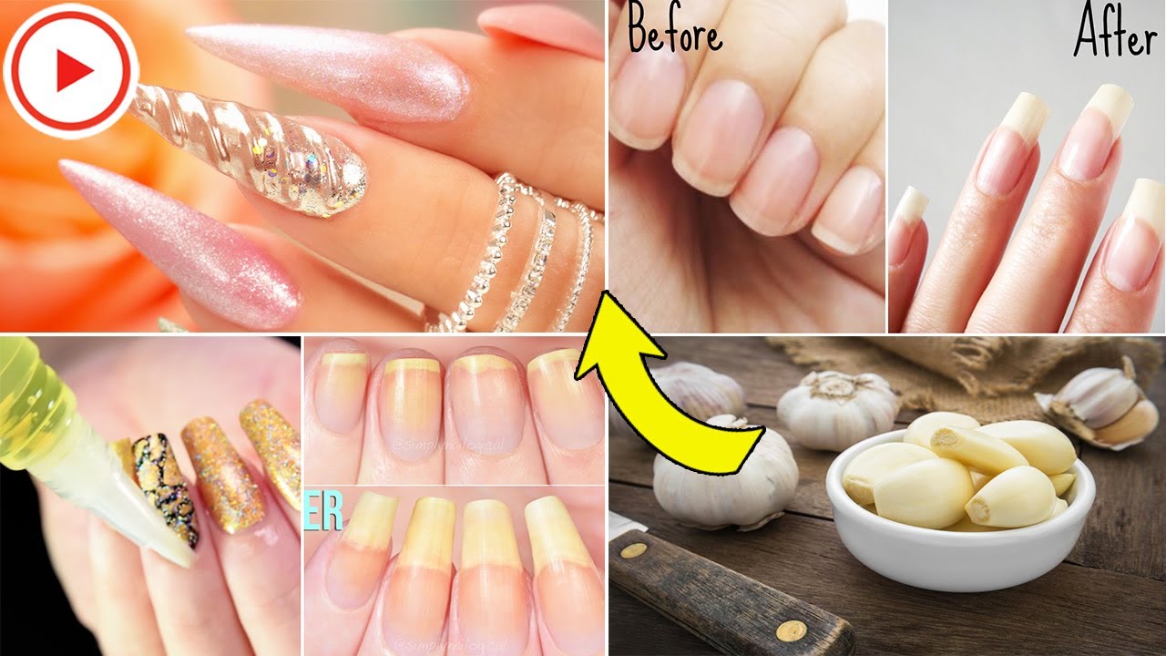 How To Use Garlic And Lemon To Strengthen Your Nails Garlic Oil For