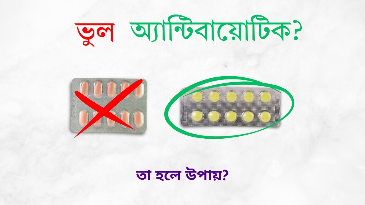 UTI in Women: Step by Step Treatment Guide