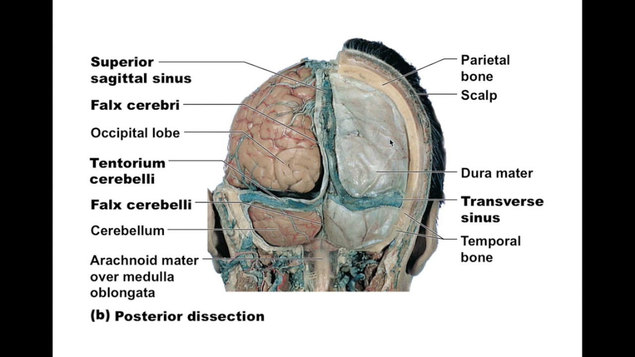 Chapter 12.8 Protection of the Brain BIO201 YouTube