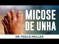 Micose de Unha - Dr. Paulo Müller Dermatologista