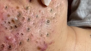 𝐂𝐡𝐢𝐥𝐥 𝐘𝐨𝐮𝐫 𝐋𝐢𝐟𝐞 𝐖𝐢𝐭𝐡 𝐋𝐍𝐆 𝐒𝐤𝐢𝐧 𝐂𝐚𝐫𝐞 # #6250