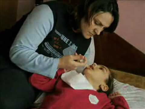 SSPE (ölümcül Kızamık Virüsü) Hastalığı Nedir?