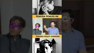 kecanduan tiktok kena sindrom pargoy