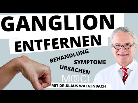 Video: Hygrom Am Finger - Ursachen, Symptome Und Behandlung