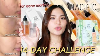 14-DAY CHALLENGE TO FADE DARK SPOTS USING NACIFIC DAY & NIGHT SET! 😱 (With Photos) • Joselle Alandy