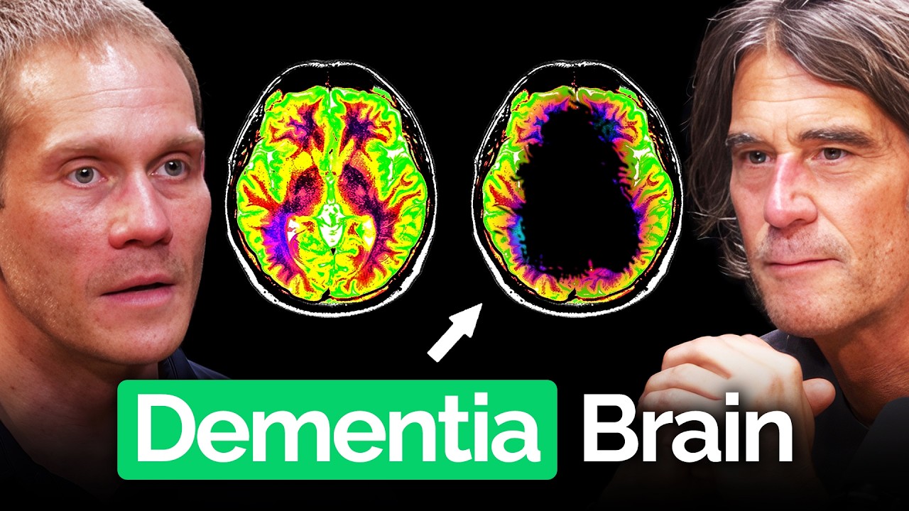 Neuroscientist Warning: These Daily Habits Are Raising Your Dementia Risk