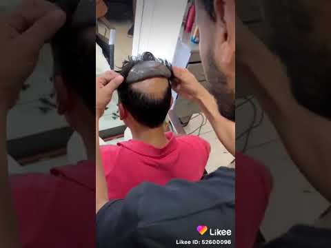 Bidaarta Oo Daawo Loohelay 