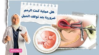 هل لازم عملية تنظيف و كحت الرحم  بعد توقف الحمل ؟| د. ريهام الشال