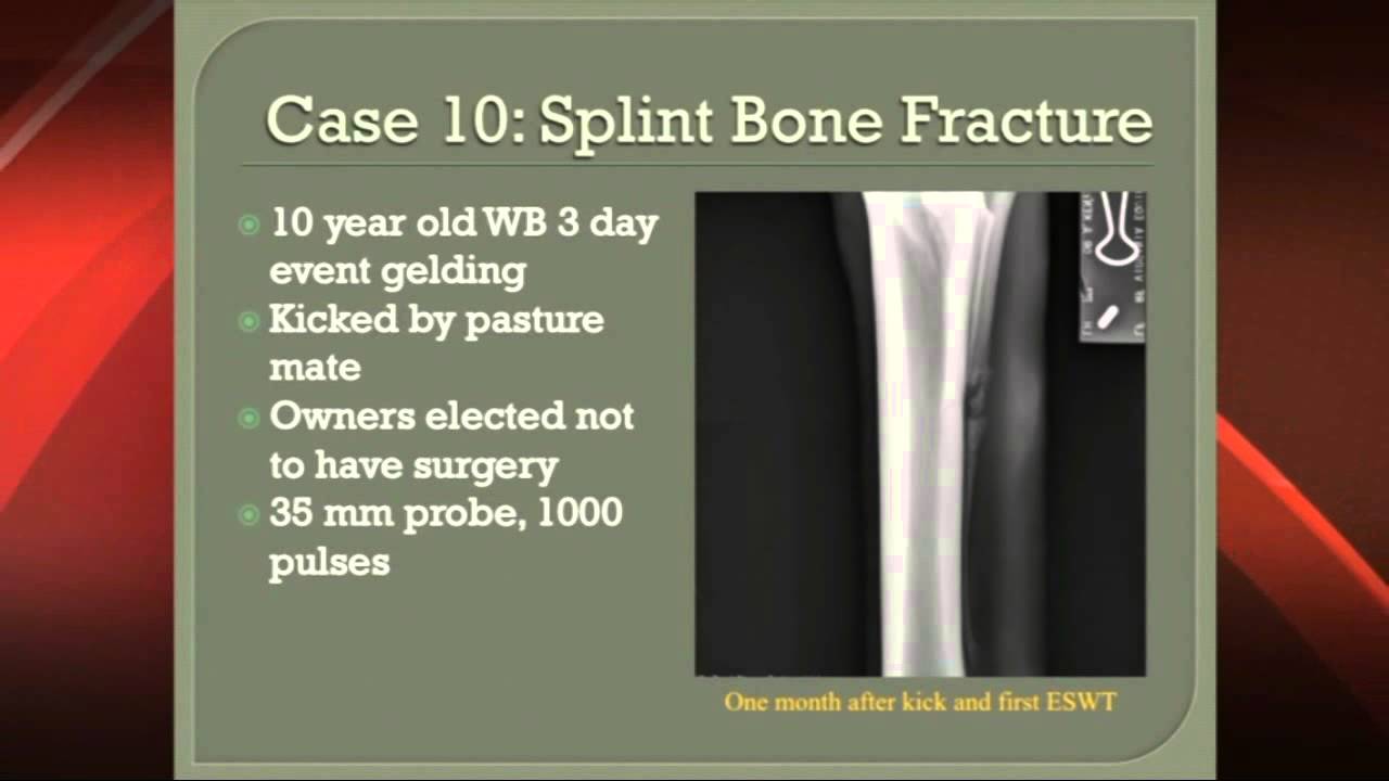 VersaTron Shock Wave - Dr Kent Allen Splint Bone Fractures - YouTube