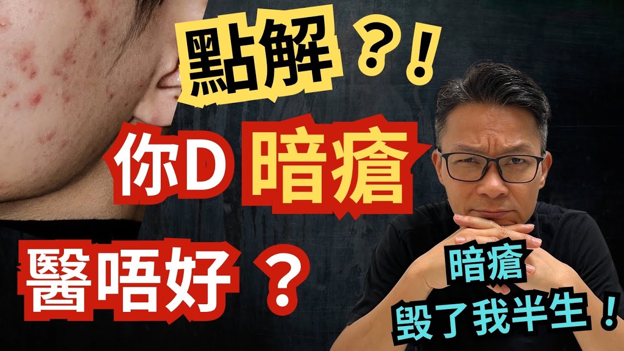 暗瘡醫極唔好，唔係你的錯，只因你沒有針對病因？根治其實好簡單！  #濕疹 skincare 暗瘡 #玫瑰痤瘡 #皮膚發炎 #濕疹 #牛皮癬