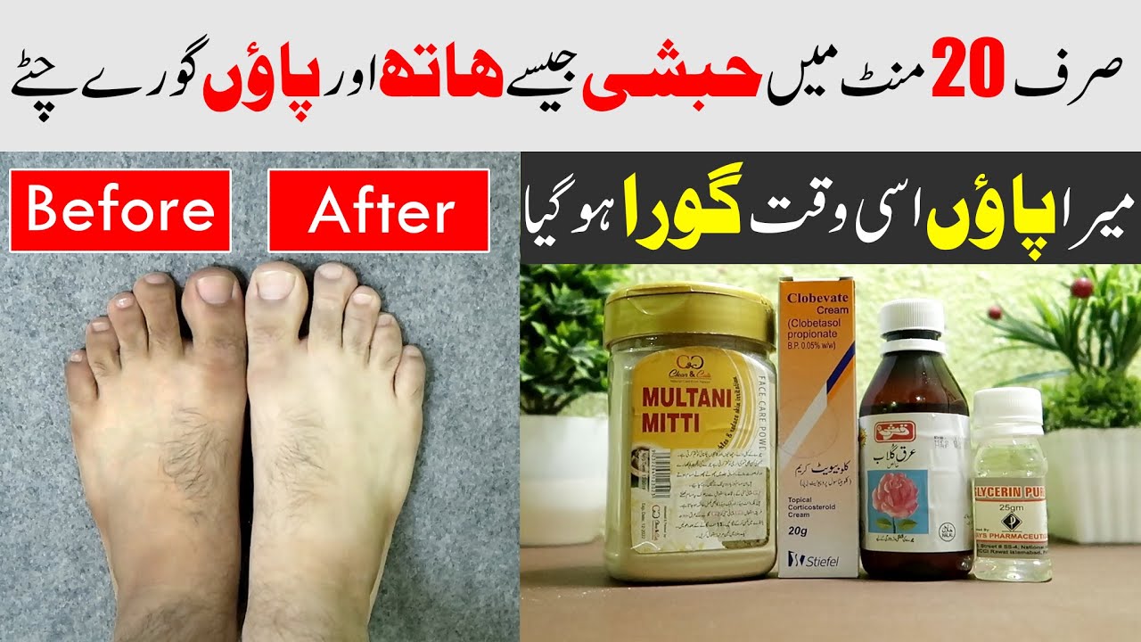 How to Lighten Your Dark Hands and Feet Whiten Hands & Feet