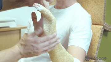 Onbone Ulna Gutter instruction video