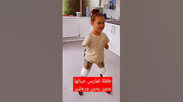 تمارس حياتها بدون يدين ورجلين العراق 