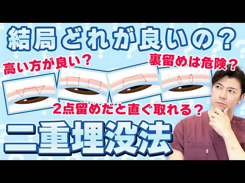 高い埋没法と安い埋没法  一体何が違うの？？ 良い埋没法の種類を見抜く方法教えます！【水の森美容クリニック】