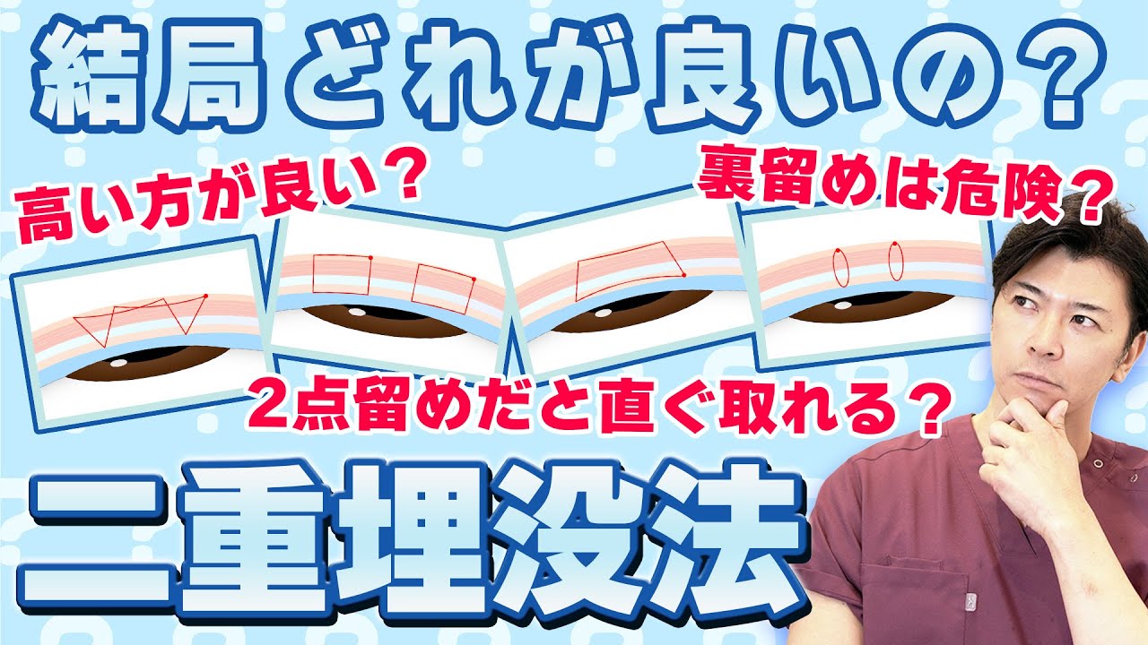 高い埋没法と安い埋没法  一体何が違うの？？ 良い埋没法の種類を見抜く方法教えます！【水の森美容クリニック】