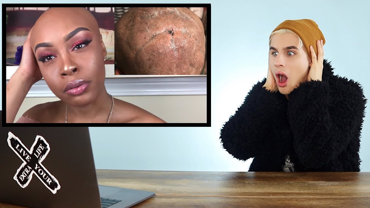 This Weeks Craziest Viral Hair Videos Balding From A Weave Ep