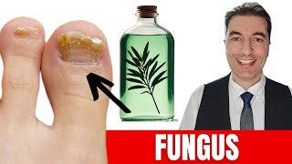 The Miraculous POWDER Removes FUNGAL INFECTIONS OF THE FEET In 24 Hours!