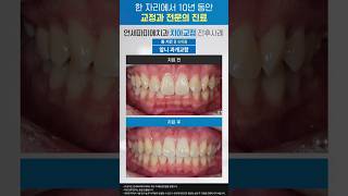 💙 #치아교정 #연세파미에치과 #치과추천 #hongdae #seouldentist #orthodontics