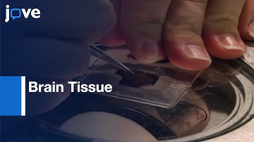 Brain Tissue Preparation for Immunohistochemistry and Microscopy | Protocol Preview