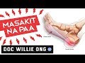 MASAKIT na PAA (Plantar Fasciitis) -  ni Doc Willie at Liza Ong #377b