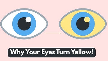 Jaundice Explained: Causes, Symptoms & Treatment
