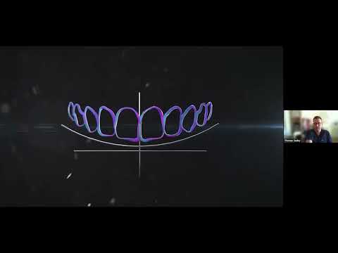 SmileFast Webinar: Learn how you can place up to 10 composite veneers in 90 minutes - video from Aurum Group