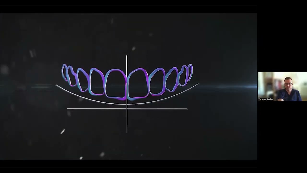 SmileFast Webinar: Learn how you can place up to 10 composite veneers in 90 minutes
