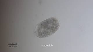 Pond Life Through the Microscope: Assorted Critters 10