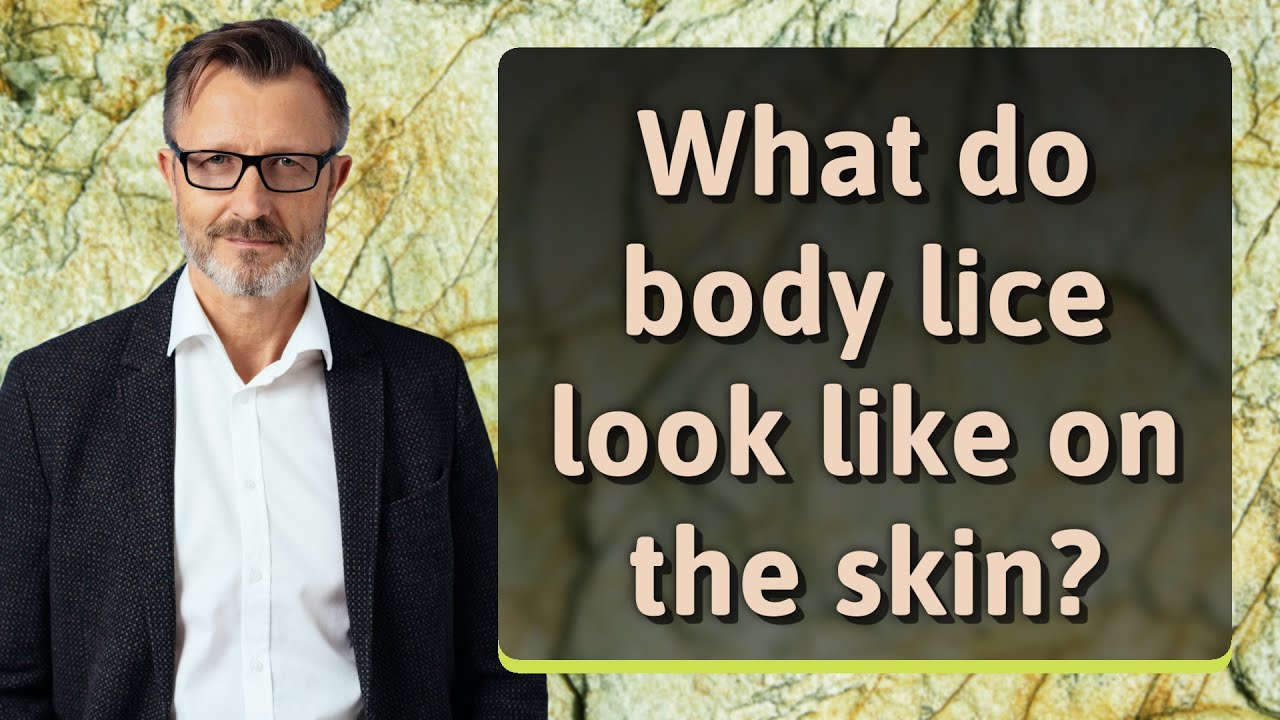 What do body lice look like on the skin? YouTube