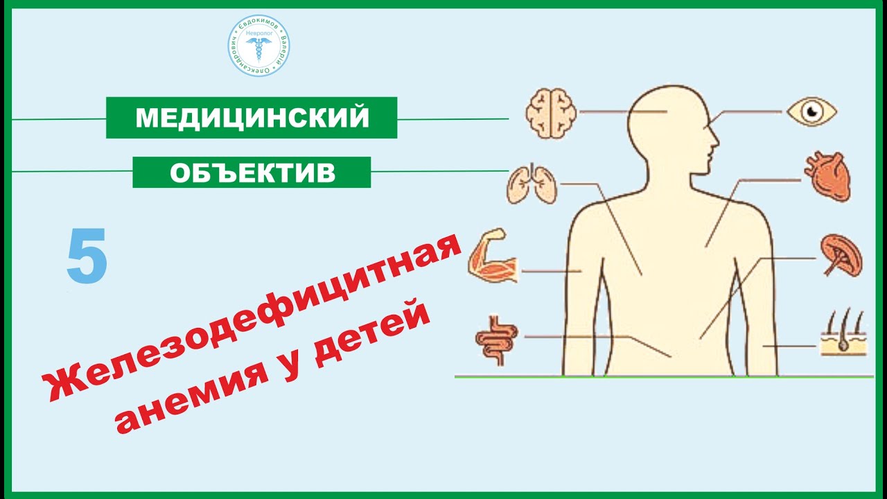 Железодефицитная анемия у детей